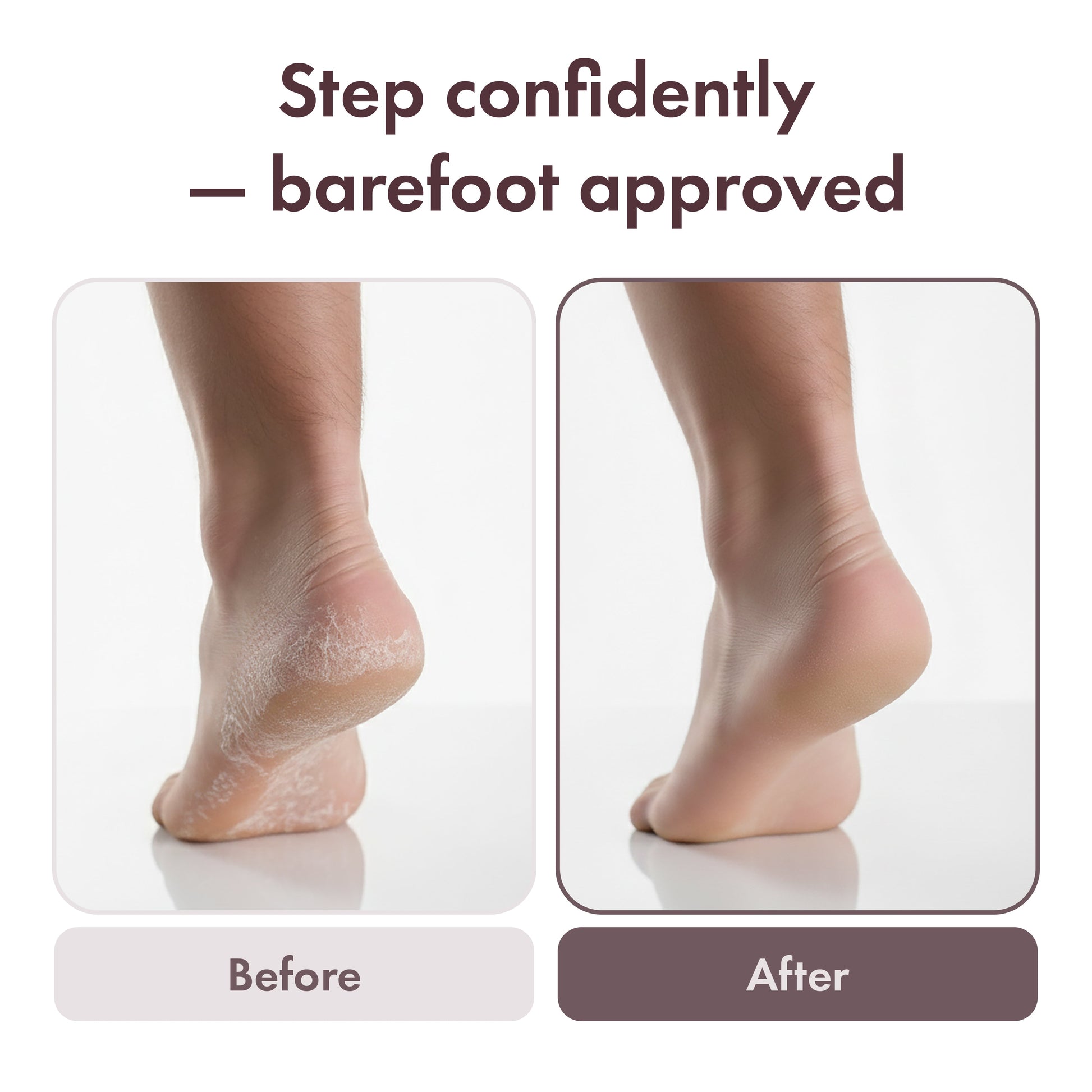 mavie-eff01-electric-foot-file-beforeandafter