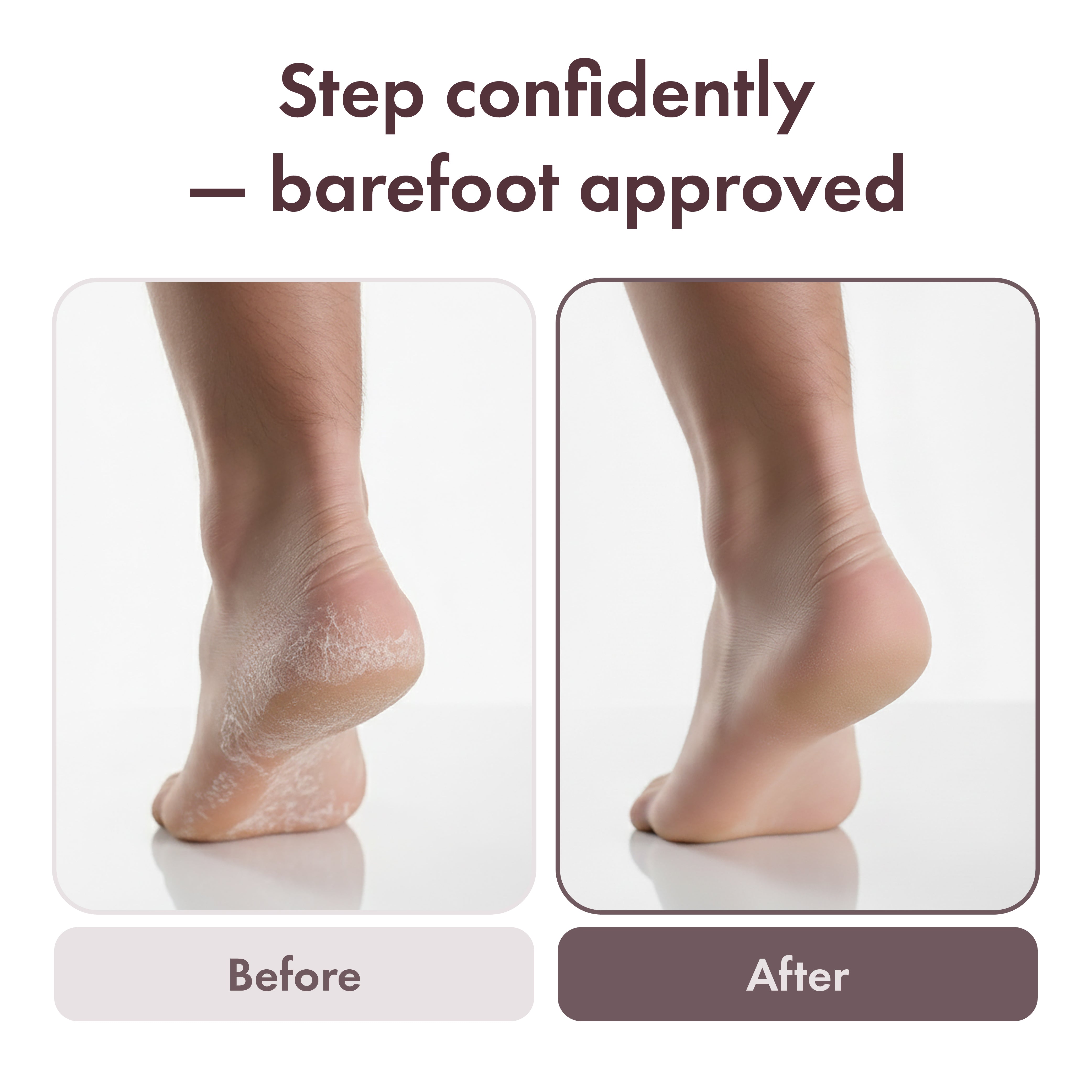 mavie-eff01-electric-foot-file-beforeandafter